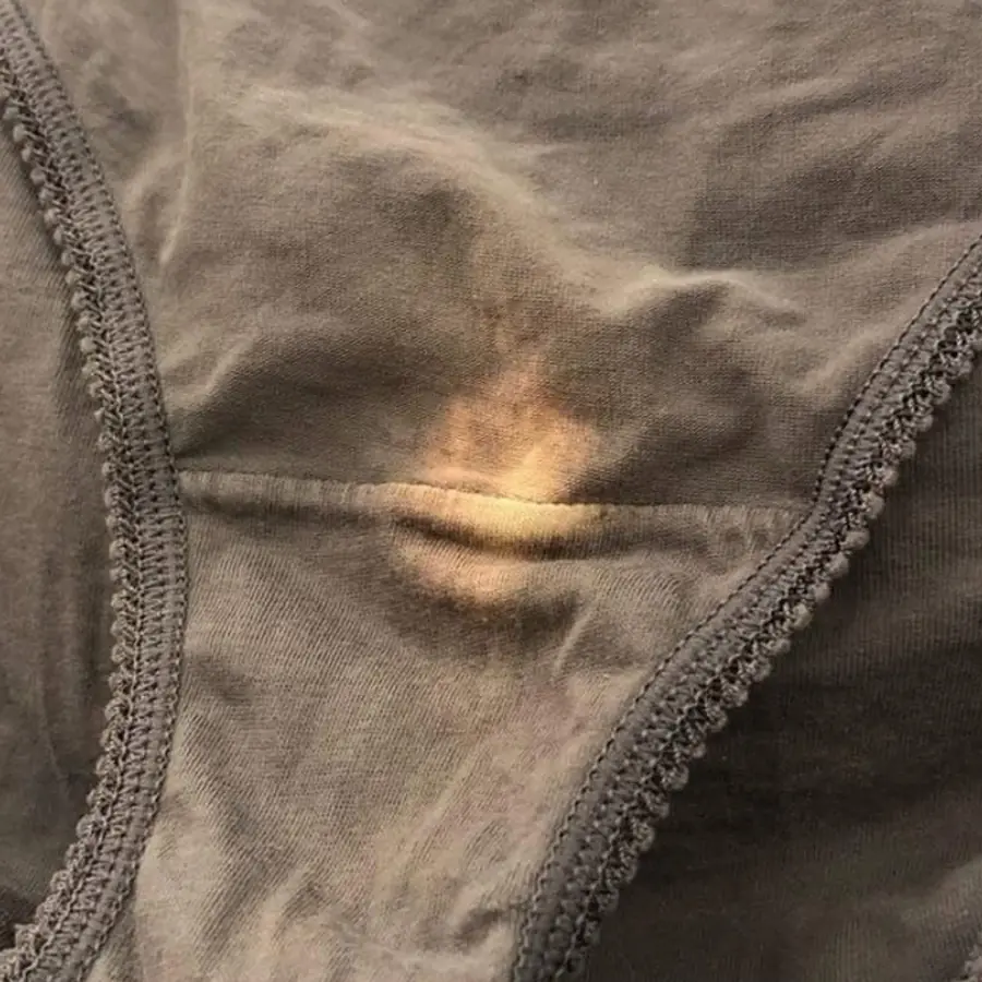 O Mistério por Trás das Manchas de "Alvejante" na Roupas Íntimas e o que Elas Realmente Significam