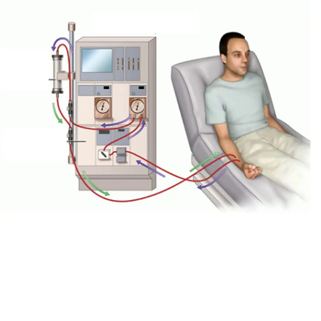 8 sinais de insuficiência renal que, se ignorados, podem exigir diálise por toda a vida