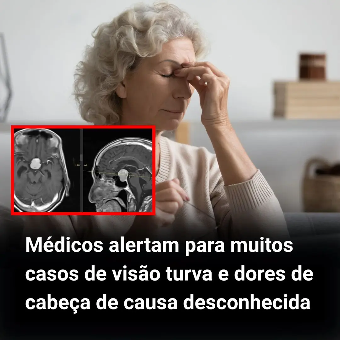 Médicos alertam para muitos casos de visão turva e dores de cabeça de ...