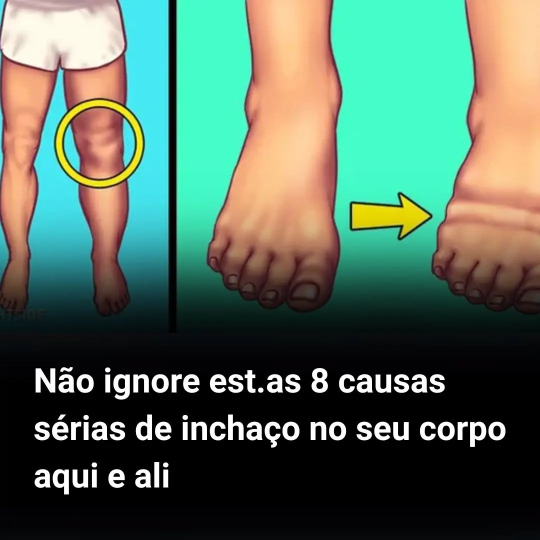 Não ignore estas 8 causas sérias de inchaço no seu corpo aqui e ali