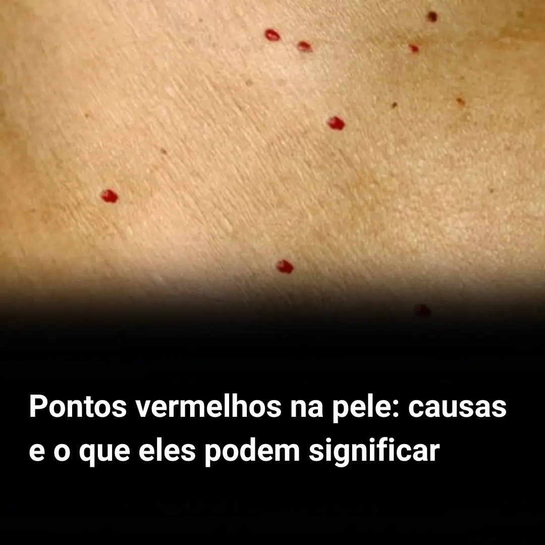 Pontos vermelhos na pele: causas e o que eles podem significar