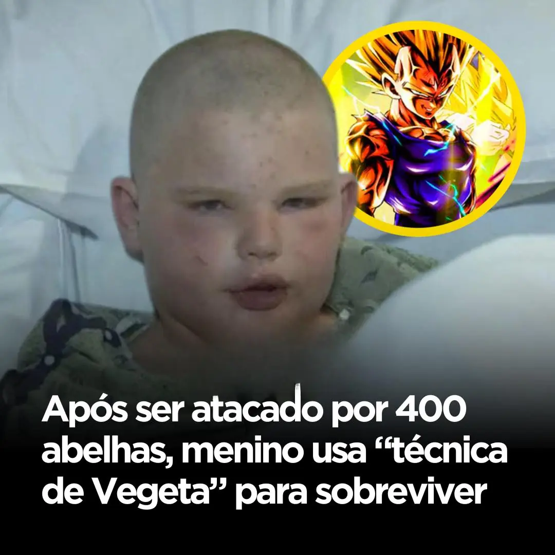 Um menino de 11 anos, identificado como Andrew Kunz, sobreviveu após ser atacado