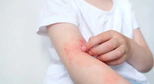 Atenção: estes 8 sintomas podem indicar que seus rins não estão funcionando bem