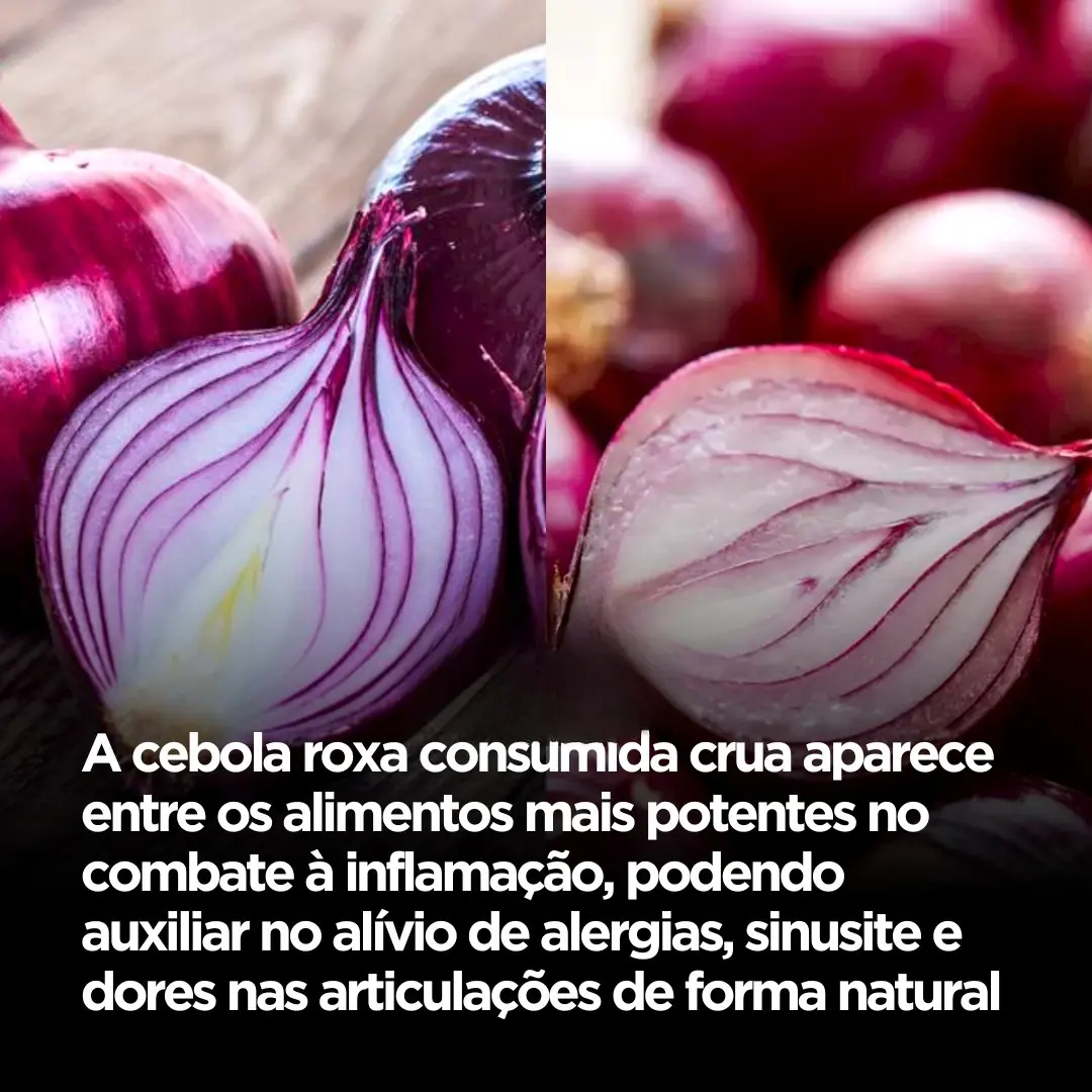 A cebola roxa crua vem sendo associada a efeitos anti-inflamatórios