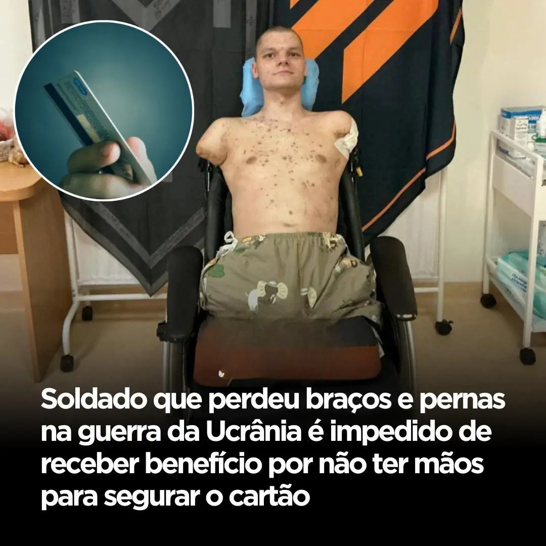 A guerra deixou marcas irreversíveis na vida de Oleksii,