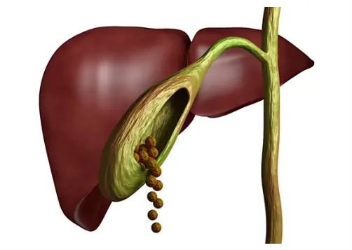 Geen galblaas? Ontdek hoe je lichaam in de loop der tijd kan veranderen.