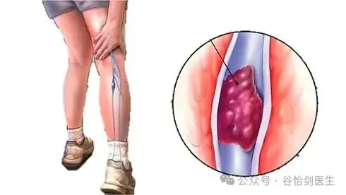 Het is cruciaal om de signalen vroegtijdig te herkennen.