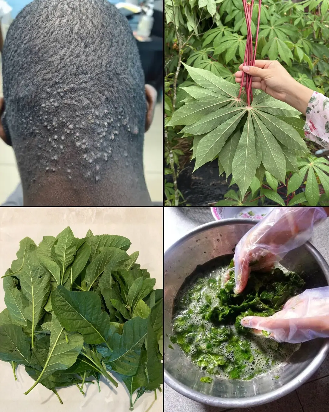 Carocinhos na parte de trás da cabeça: o que pode ser e o que realmente ajuda