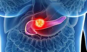 O diagnóstico de câncer avançado parecia o fim… até que uma nova terapia trouxe uma reviravolta inesperada