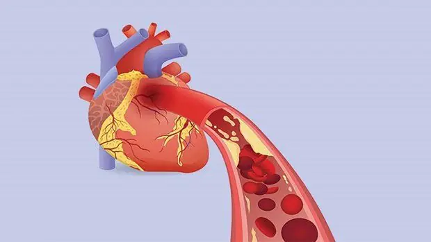 Estas 3 práticas matinais podem aumentar pressão e colesterol