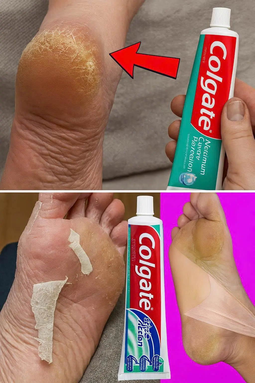O Segredo da Colgate: O Truque Caseiro para Eliminar Pontos Negros