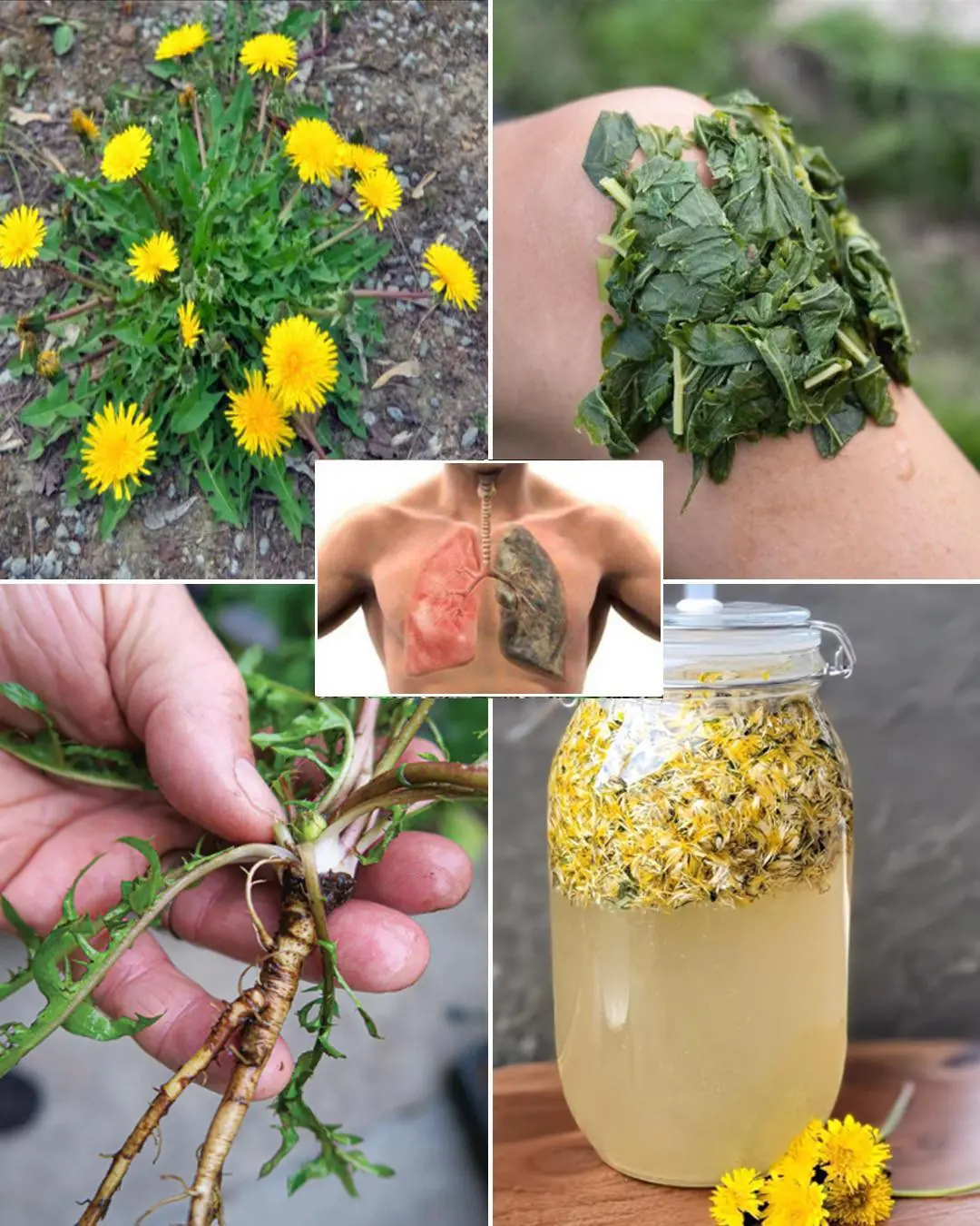 O Poder Oculto do Dente-de-Leão: A Superplanta da Medicina Natural