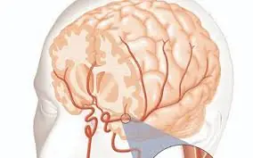 Estudo levanta nova hipótese sobre proteína que poderia influenciar múltiplos tipos de câncer.