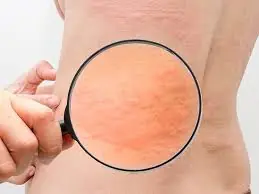Uma simples coceira pelo corpo inteiro acabou levando a uma descoberta inesperada