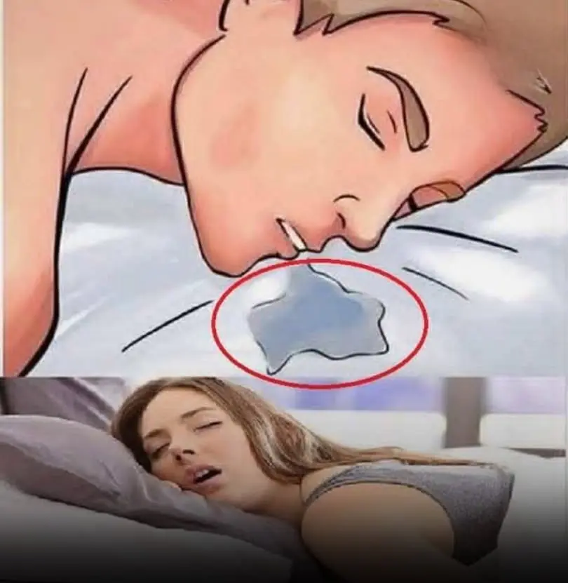 Don’t Ignore Frequent Drooling