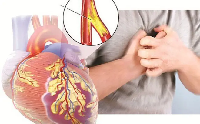 7 alertas que seu corpo pode enviar quando a pressão arterial está baixa