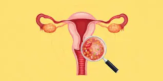Especialistas alertam: 3 hábitos íntimos que podem fazer diferença para a saúde feminina