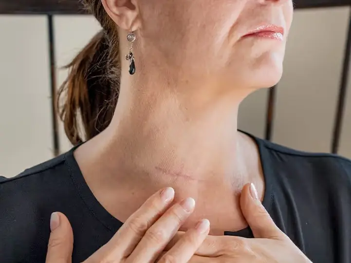 Não ignore veias salientes no pescoço — elas podem sinalizar algo mais sério do que você imagina.