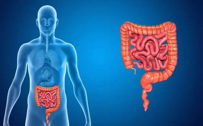 6 sinais de que seu intestino pode precisar de atenção médica imediata